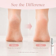 Smooth Heel Buffer